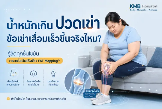 ภาพอินโฟกราฟิก KMB Hospital เรื่องน้ำหนักเกินกับอาการปวดเข่าและข้อเข่าเสื่อมเร็ว แสดงผู้หญิงนั่งจับเข่าอย่างเจ็บปวด พร้อมสื่อถึงแรงกดที่ข้อเข่าและการเสื่อมของข้อจากน้ำหนักเกิน และแนะนำการประเมินสุขภาพร่วมกับ FAT Mapping เพื่อดูความเสี่ยงเชิงลึก