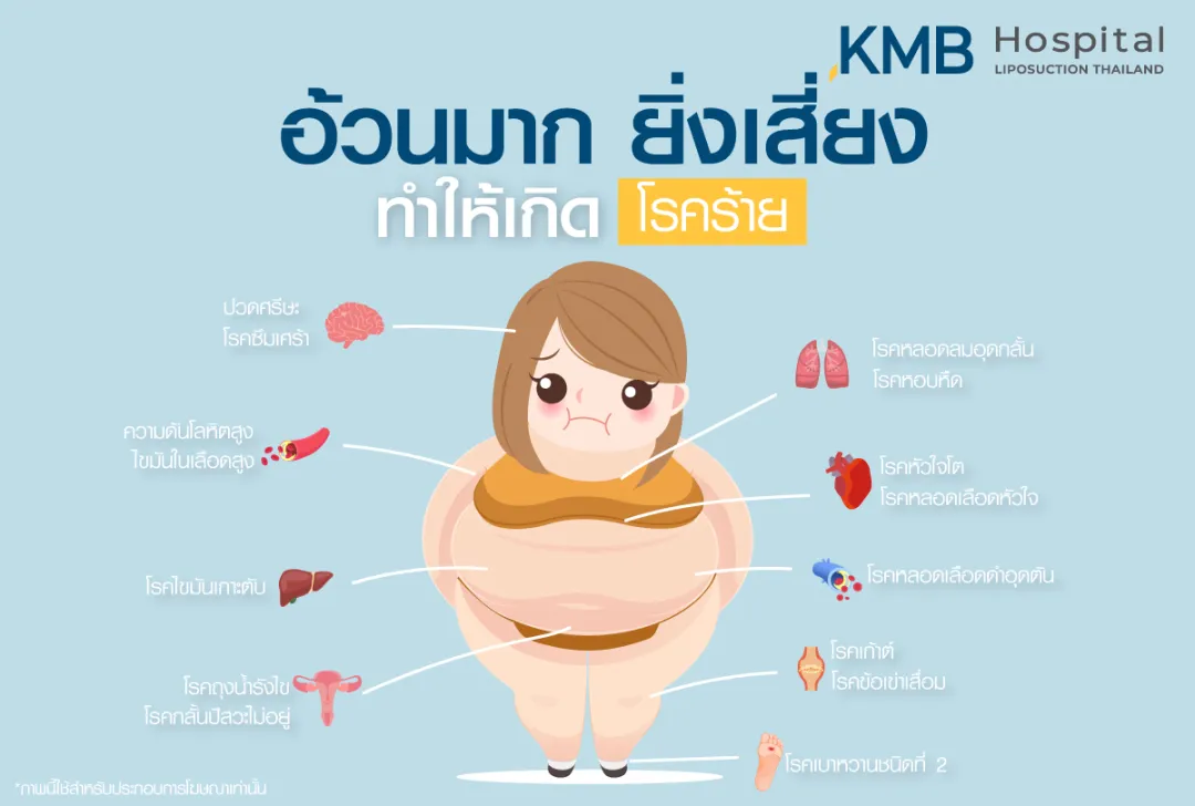 อ้วนมากยิ่งเสี่ยง ทำให้เกิดโรคร้าย