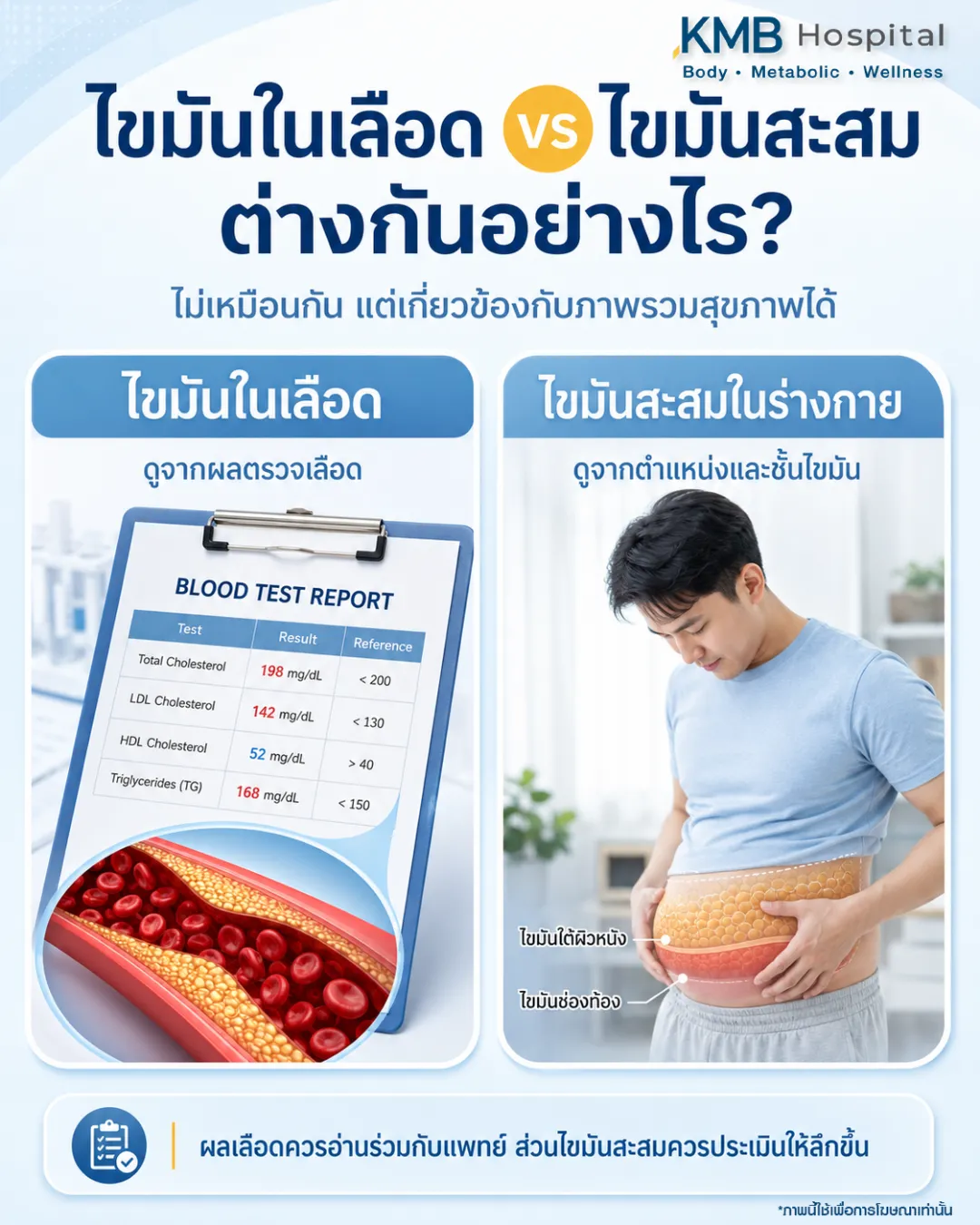 ภาพอินโฟกราฟิก KMB Hospital อธิบายความแตกต่างระหว่างไขมันในเลือดและไขมันสะสมในร่างกาย แสดงตัวอย่างผลเลือดและไขมันสะสมรอบพุง พร้อมแนะนำให้ประเมินปัจจัยร่วมของร่างกายเพื่อความเข้าใจสุขภาพโดยรวม