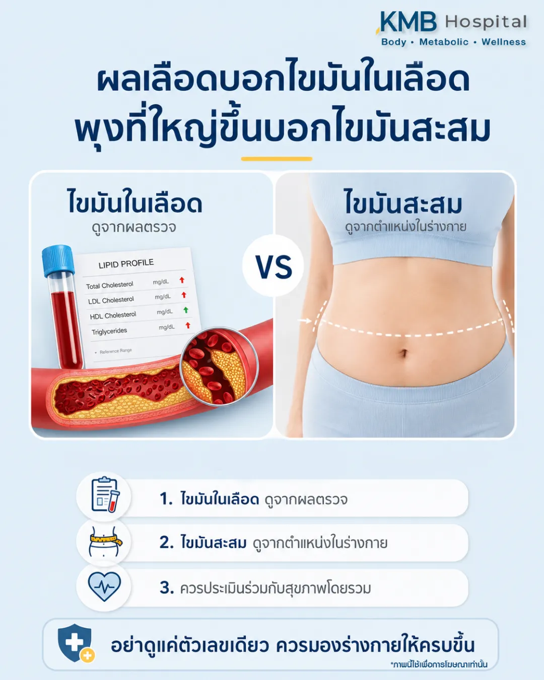 ภาพอินโฟกราฟิก KMB Hospital เรื่องไขมันในเลือด vs ไขมันสะสม แสดงความแตกต่างของการวัดไขมันจากผลตรวจเลือดและการประเมินตำแหน่งและชั้นไขมันในร่างกาย พร้อมแนะนำให้ดูภาพรวมสุขภาพร่วมกับ FAT Mapping