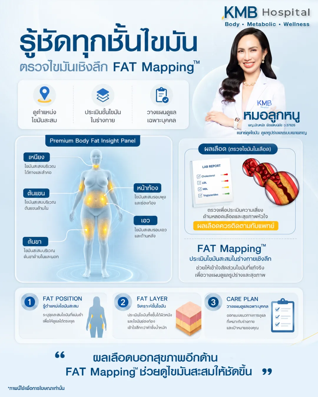 ภาพอินโฟกราฟิก KMB Hospital อธิบายการตรวจ FAT Mapping วิเคราะห์ไขมันเชิงลึกและประเมินตำแหน่งไขมันในร่างกาย เพื่อเปรียบเทียบไขมันในเลือดและไขมันสะสม พร้อมวางแผนดูแลสุขภาพอย่างเฉพาะบุคคล