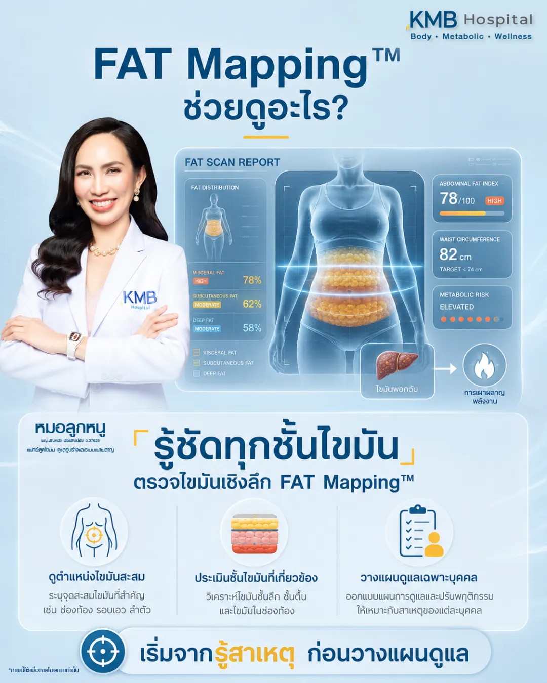 ภาพอินโฟกราฟิก KMB Hospital อธิบายว่า FAT Mapping ช่วยตรวจไขมันเชิงลึก วิเคราะห์ตำแหน่งไขมันสะสม ประเมินชั้นไขมันที่เกี่ยวข้อง และช่วยวางแผนดูแลเฉพาะบุคคลโดยเริ่มจากการรู้สาเหตุก่อนวางแผนดูแล