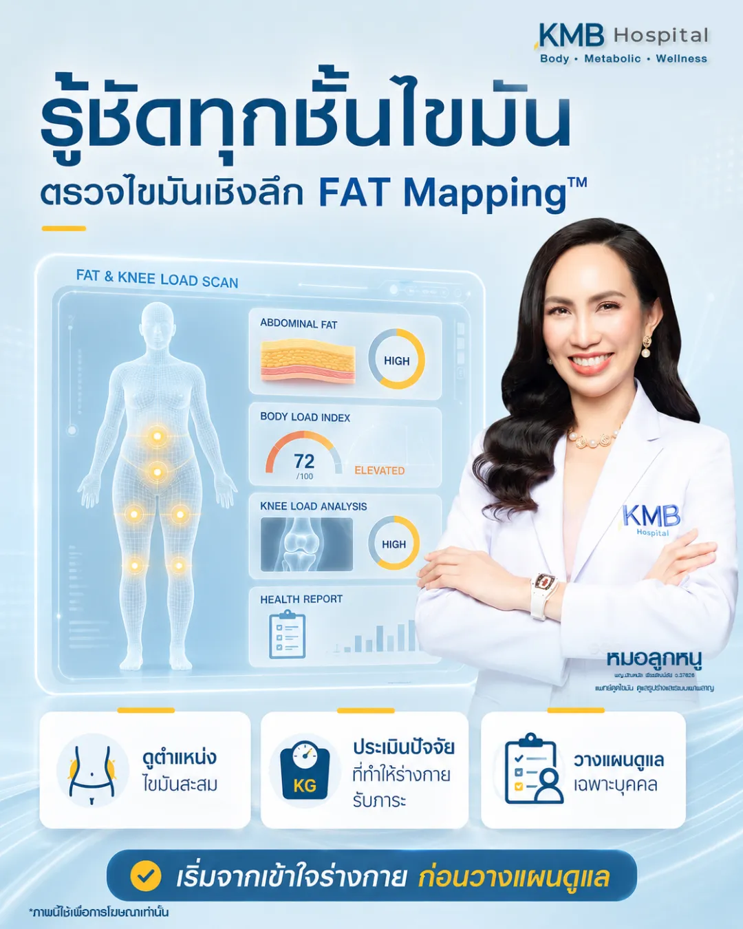 ภาพอินโฟกราฟิก KMB Hospital อธิบายการตรวจ FAT Mapping วิเคราะห์ไขมันเชิงลึกและประเมินการรับภาระของข้อเข่า ร่วมกับองค์ประกอบร่างกาย เพื่อวางแผนดูแลเฉพาะบุคคลอย่างเหมาะสม