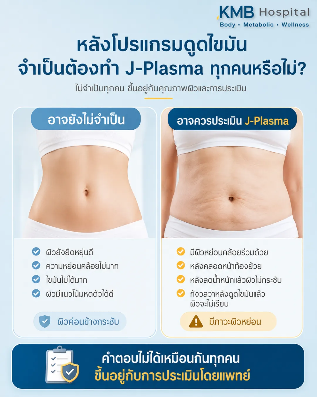 อินโฟกราฟิก KMB Hospital อธิบายว่าหลังโปรแกรมดูดไขมันไม่จำเป็นต้องทำ J-Plasma ทุกคน โดยควรประเมินคุณภาพผิว ความหย่อนคล้อย และความกระชับของผิวโดยแพทย์ก่อนวางแผนดูแล