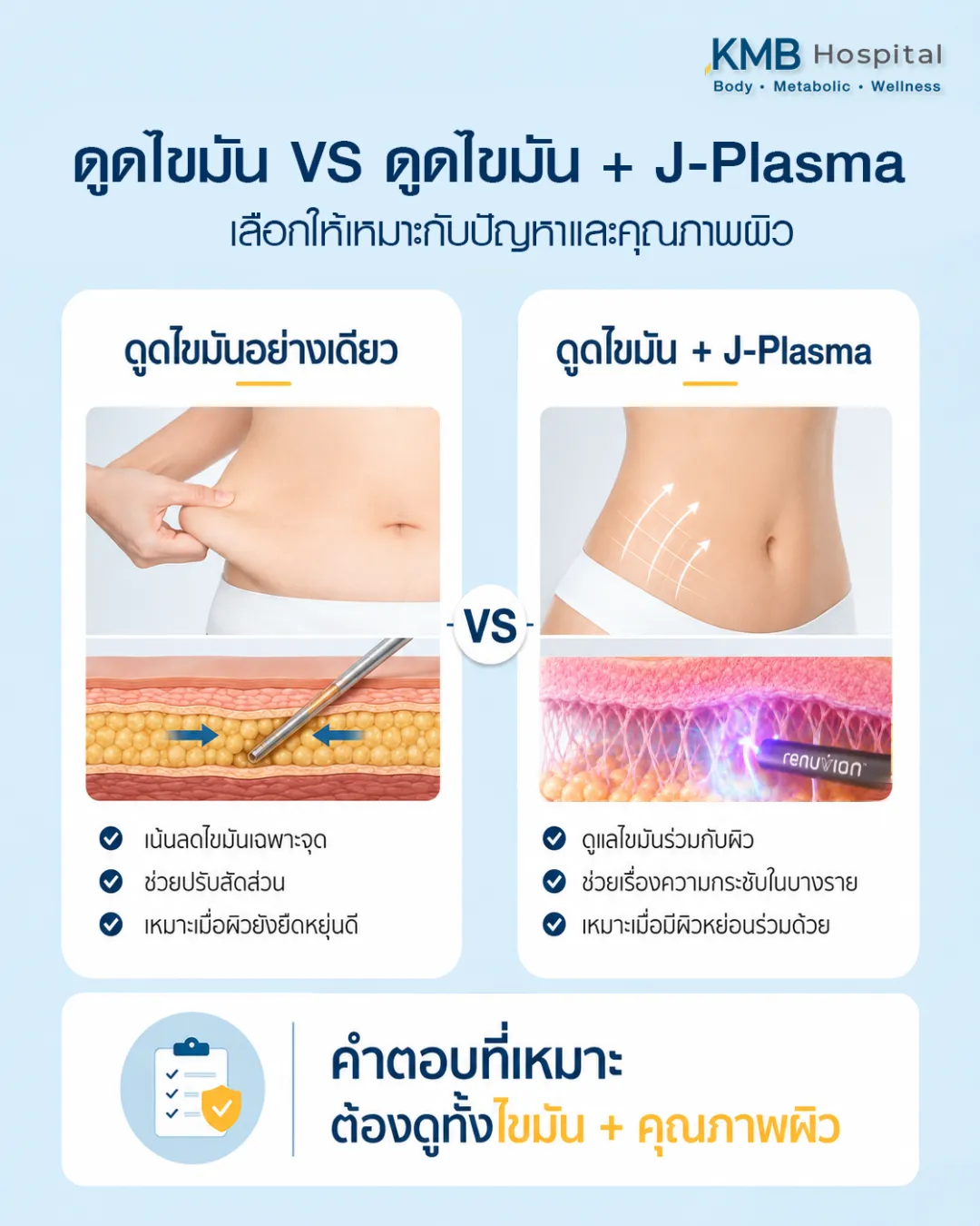 ภาพเปรียบเทียบการดูดไขมันอย่างเดียวกับการดูดไขมันร่วม J-Plasma โดยเน้นให้ประเมินทั้งปริมาณไขมันและคุณภาพผิวก่อนเลือกเทคนิคที่เหมาะกับแต่ละบุคคล