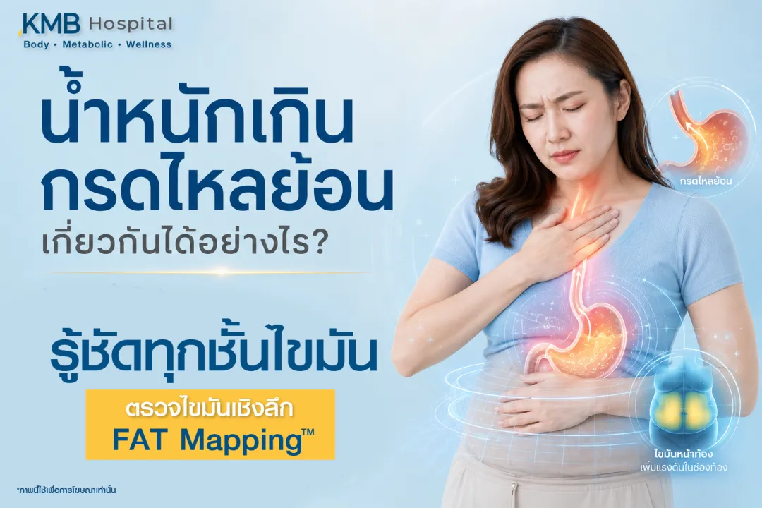 ภาพประกอบบทความ KMB Hospital เรื่องน้ำหนักเกินกับกรดไหลย้อน แสดงผู้หญิงมีอาการแสบร้อนบริเวณหน้าอกและกระเพาะ พร้อมสื่อถึงไขมันหน้าท้องที่อาจเพิ่มแรงดันในช่องท้อง และการตรวจไขมันเชิงลึกด้วย FAT Mapping