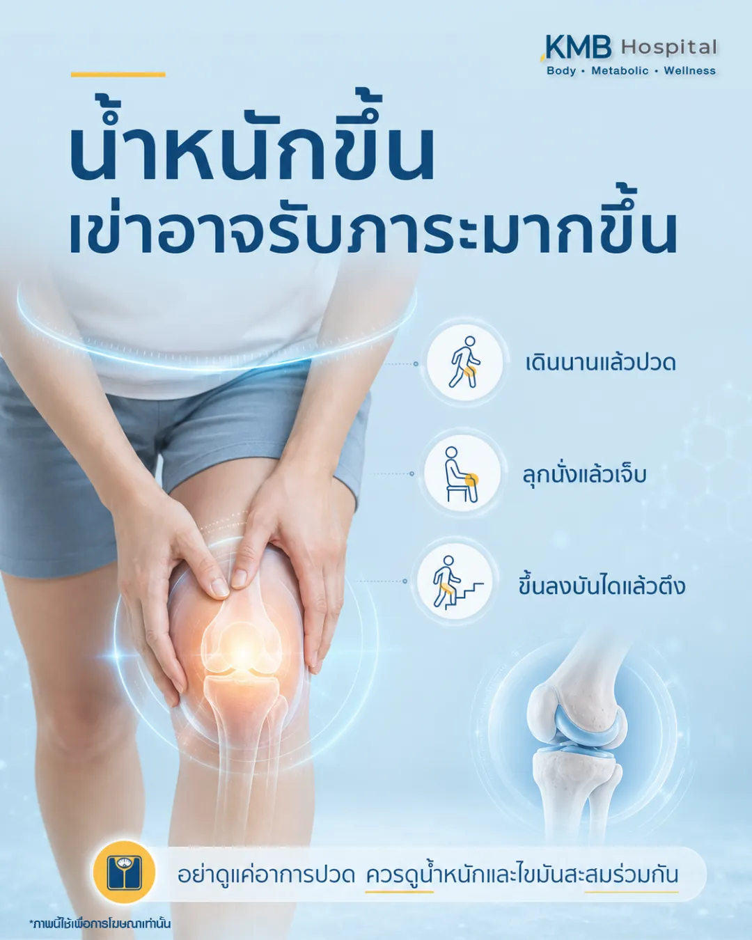 ภาพอินโฟกราฟิก KMB Hospital เรื่องน้ำหนักขึ้นส่งผลต่อข้อเข่า แสดงผู้หญิงจับเข่าพร้อมภาพไขมันสะสมหน้าท้องและแรงกดที่ข้อเข่า พร้อมแนะนำการตรวจ FAT Mapping เพื่อตรวจตำแหน่งไขมันและประเมินปัจจัยที่ทำให้ร่างกายรับภาระมากขึ้น