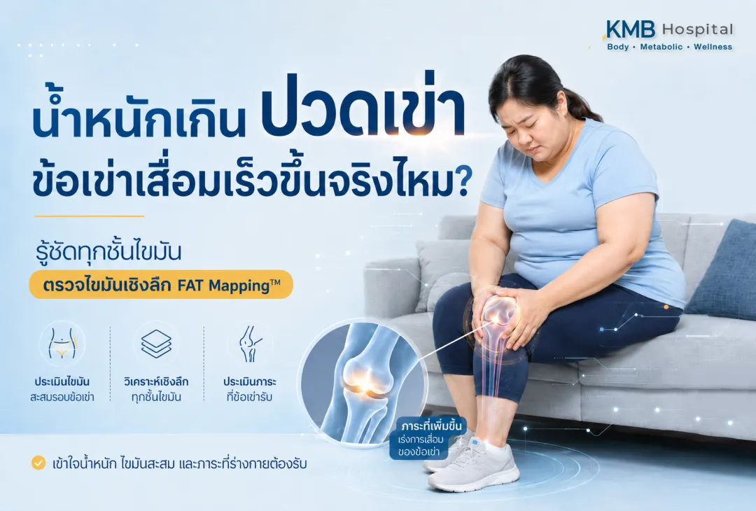 ภาพอินโฟกราฟิก KMB Hospital เรื่องน้ำหนักเกินกับอาการปวดเข่าและข้อเข่าเสื่อมเร็ว แสดงผู้หญิงนั่งจับเข่าอย่างเจ็บปวด พร้อมสื่อถึงแรงกดที่ข้อเข่าและการเสื่อมของข้อจากน้ำหนักเกิน และแนะนำการประเมินสุขภาพร่วมกับ FAT Mapping เพื่อดูความเสี่ยงเชิงลึก